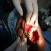 SAI LASER DENTAL CLINIC Image 3