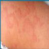 Allergy And Asthma Clinic Image 1