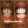 Smile Up Dental Care & Implant Center Image 6