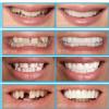 Smile Up Dental Care & Implant Center Image 5