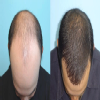 APEX PLASTIC & COSMETIC SURGERY CENTER Image 1