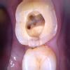 Parth dental clinic Image 4
