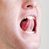 STAMMERING CURE SPEECH THERAPY CENTRE KANPUR Image 2