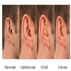 STAMMERING CURE SPEECH THERAPY CENTRE KANPUR Image 4