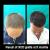 Delight Clinic - Hair Transplant,Laser & Cosmetic Surgery Centre Image 7