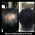 Delight Clinic - Hair Transplant,Laser & Cosmetic Surgery Centre Image 1