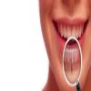 JS Rathore Dental & Physiotherapy Clinic, 8527744087 Image 3