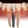 JS Rathore Dental & Physiotherapy Clinic, 8527744087 Image 4