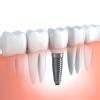 JS Rathore Dental & Physiotherapy Clinic, 8527744087 Image 1