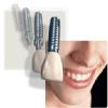 JS Rathore Dental & Physiotherapy Clinic, 8527744087 Image 2