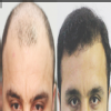 Anagen Hair ,Skin & Obesity Image 1