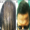 Anagen Hair ,Skin & Obesity Image 3