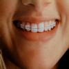 Smile Isle Dental Care Image 8