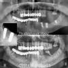 Dr. Saini's Dental Studio Image 5