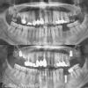 Dr. Saini's Dental Studio Image 8