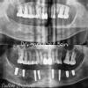 Dr. Saini's Dental Studio Image 4