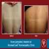 HomeoCure™ Homeopathy Clinic, Tilak Road Image 9