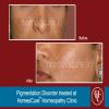 HomeoCure™ Homeopathy Clinic, Tilak Road Image 10