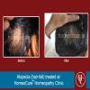 HomeoCure™ Homeopathy Clinic, Tilak Road Image 8
