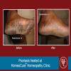 HomeoCure™ Homeopathy Clinic, Tilak Road Image 7