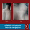 HomeoCure™ Homeopathy Clinic, Tilak Road Image 6