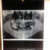 32 Signature Smiles-AHRC Dental & Faciomaxillary Clinic Image 6