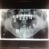 32 Signature Smiles-AHRC Dental & Faciomaxillary Clinic Image 7