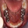 32 Signature Smiles dental clinic Image 8