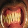 32 Signature Smiles dental clinic Image 4