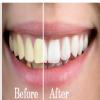 32 Signature Smiles dental clinic Image 3