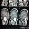 Dr.Kaustubh Dindorkar's Brain & Spine Surgery Clinic Image 1