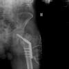 ORTHOPEDIC CLINIC- RAGHAVA MULTISPECIALITY HOSPITAL Image 2