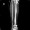 ORTHOPEDIC CLINIC- RAGHAVA MULTISPECIALITY HOSPITAL Image 5