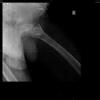 ORTHOPEDIC CLINIC- RAGHAVA MULTISPECIALITY HOSPITAL Image 3