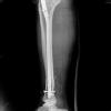 ORTHOPEDIC CLINIC- RAGHAVA MULTISPECIALITY HOSPITAL Image 4