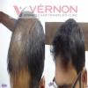 Vernon Advanced Hair Transplant Clinic Image 2