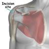 Ortho Neuro Physiotherapy Clinic Image 10