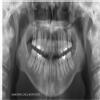 Smiline Dental Clinic & Implant Centre Image 9
