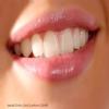 Smiline Dental Clinic & Implant Centre Image 10