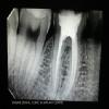 Smiline Dental Clinic & Implant Centre Image 7