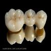 Smiline Dental Clinic & Implant Centre Image 3