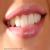 Smiline Dental Clinic & Implant Centre Image 10