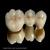 Smiline Dental Clinic & Implant Centre Image 3