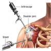 sunanda Arthroscopy and Sports medicine Clinic Image 3