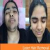 Dr. KULDEEP SINGH SKIN HAIR CLINIC & AMERICAN HAIR TRANSPLANT CLINIC Image 8