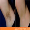 Dr. KULDEEP SINGH SKIN HAIR CLINIC & AMERICAN HAIR TRANSPLANT CLINIC Image 10