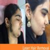 Dr. KULDEEP SINGH SKIN HAIR CLINIC & AMERICAN HAIR TRANSPLANT CLINIC Image 9
