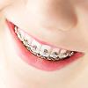 Smile Xpertz Image 5