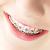 Smile Xpertz Image 5