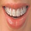 i-Smile Align Dental Clinic Image 2